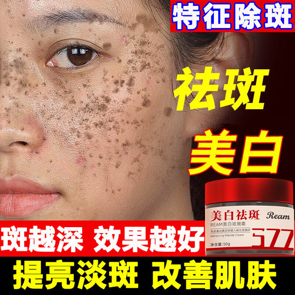 Niacinamide whitening and anti-freckle cream removes melanin, improves dullness, lightens spots and brightens skin tone 377 whitening and anti-freckle cream